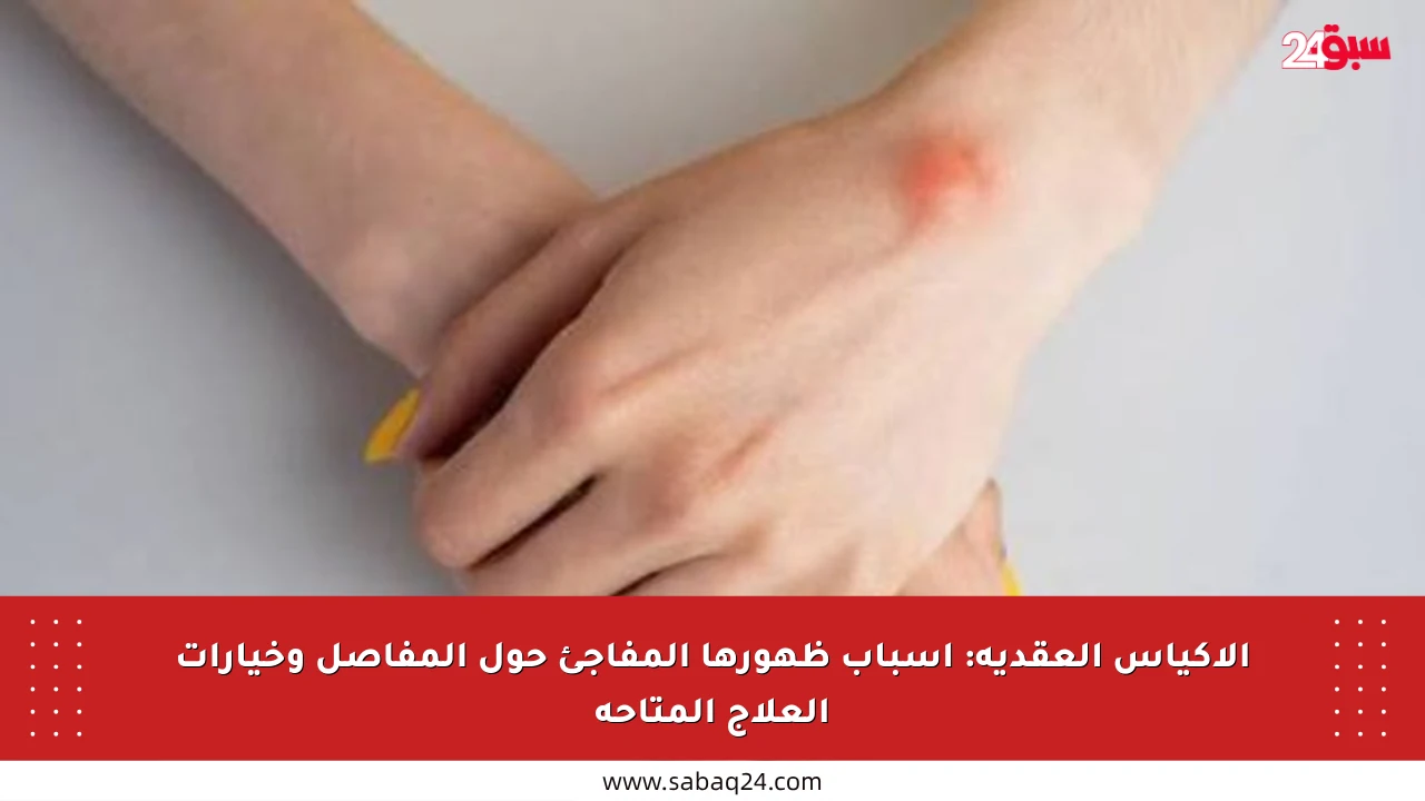 الأكياس العقدية: أسباب ظهورها المفاجئ حول المفاصل وخيارات العلاج المتاحة